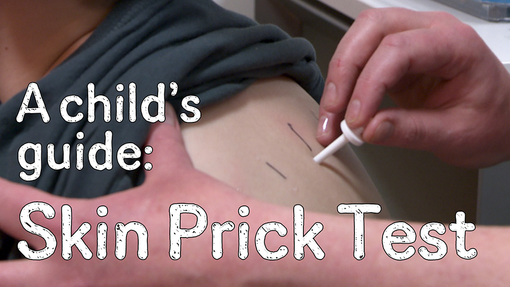 Skin Prick Test